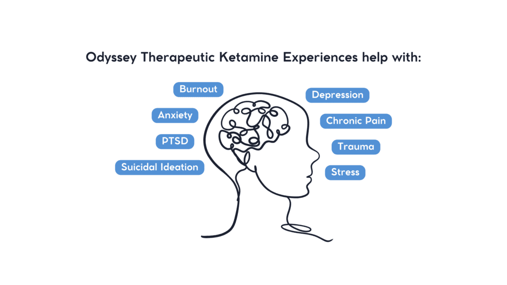 ketamine therapy for depression, ketamine for anxiety